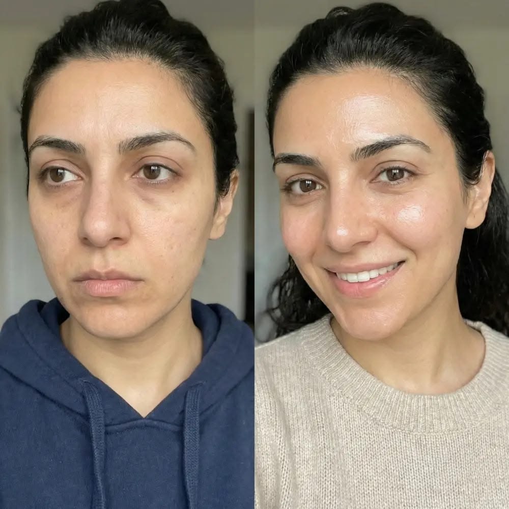 Avant/après Crème riche hydratante sans parfum FINOVA
